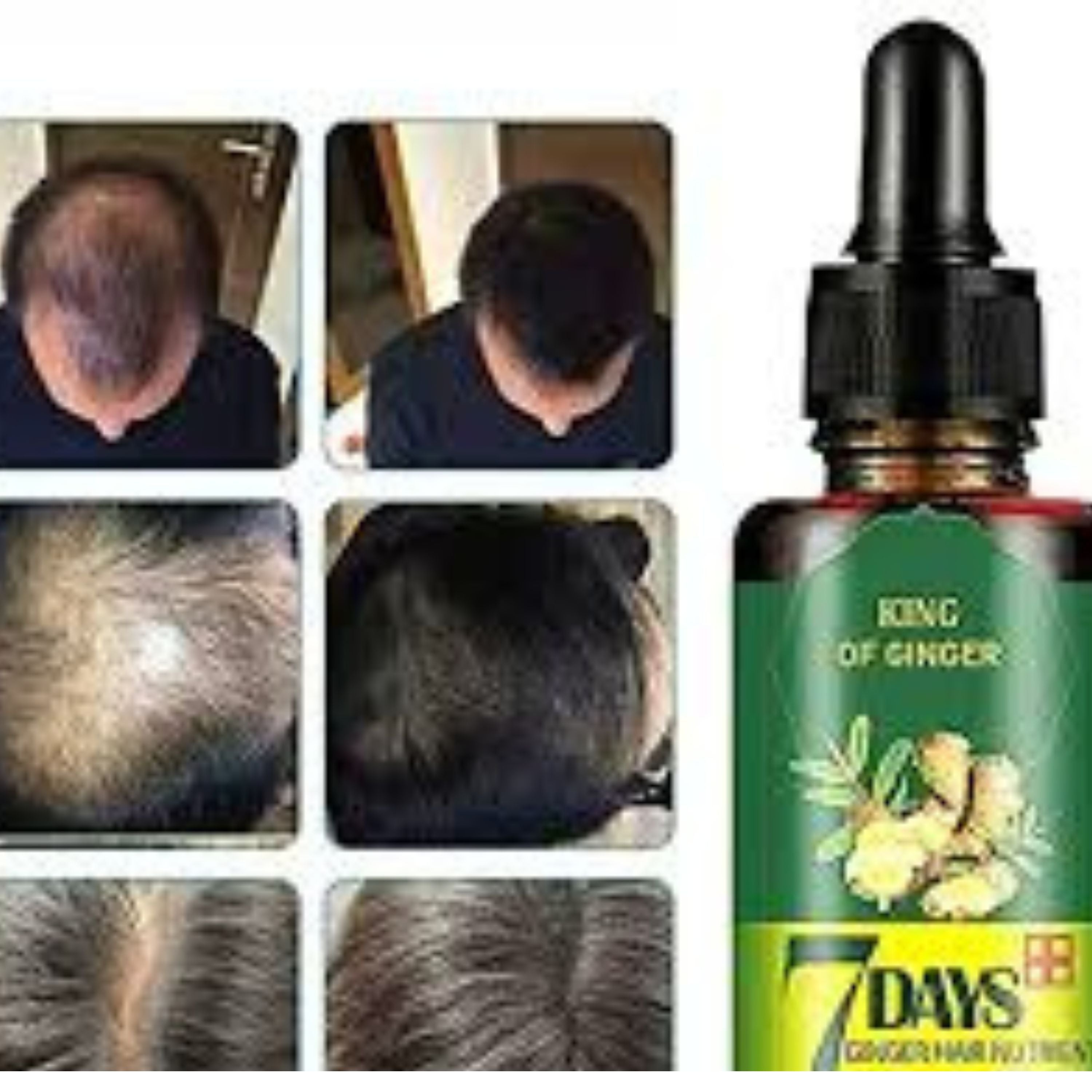 Buy 1 Get 1 FREE  Aichun Beauty 7 Days Ginger Hair Growth Essence Oil Serum For Damaged Hair Treatment Hair Growth Oil 30ml