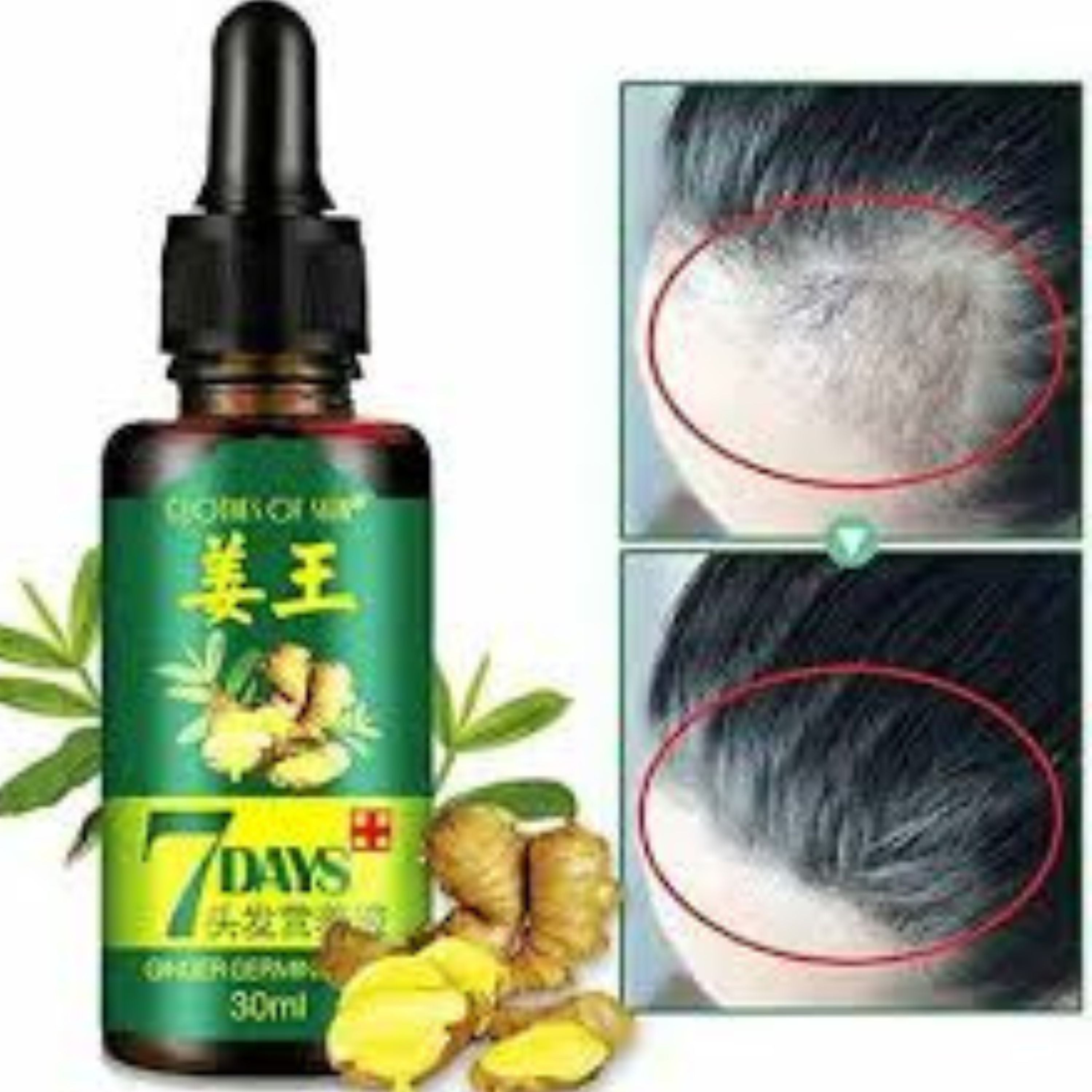 Buy 1 Get 1 FREE  Aichun Beauty 7 Days Ginger Hair Growth Essence Oil Serum For Damaged Hair Treatment Hair Growth Oil 30ml